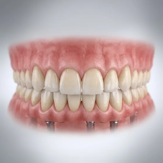 A full arch of fixed natural-looking teeth