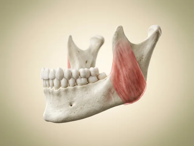 The masseter chewing muscle highlighted on the jaw