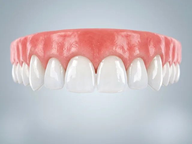 Healthy clean teeth after a fluoride treatment