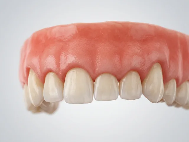 Uneven gumline before reshaping