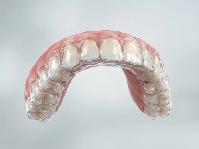 La guarda nocturna colocada sobre los dientes